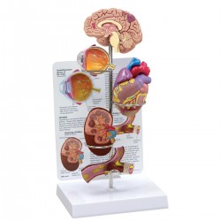 Hypertensie model met info kaart