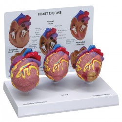 3 mini hart set + infokaart 3 mini hart set + infokaart