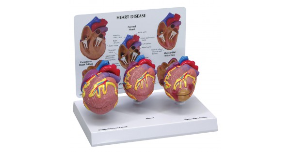 3 mini heart set + infokaart