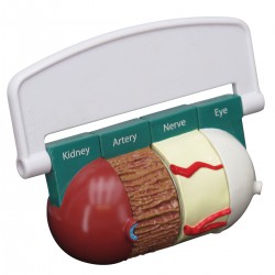 4-delig Diabetes Model