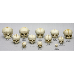 Foetus set van 12 schedels op standaard