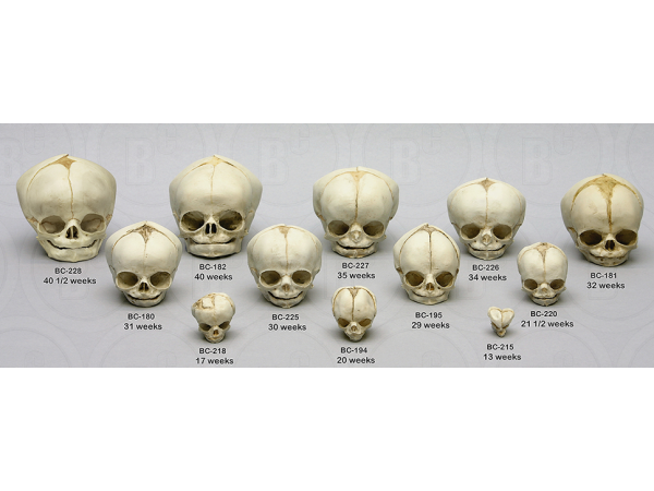 Foetus set van 12 schedels op standaard