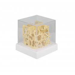 Botstructuur Vergelijkingsmodel (Gezond/Osteoporotisch)