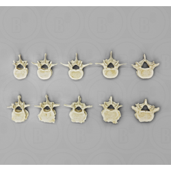 Vergelijkende Lendenwervelset (10 stuks)