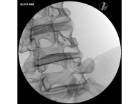 Beeldgeleide Lumbale Wervelkolom Injectie Simulator