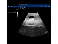 Echografie Trainer Adermodel