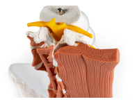 Mannelijk Bekkenmodel met Lendenwervels en Spieren